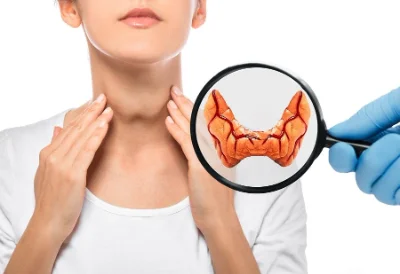 L’hypothyroïdie : comprendre une maladie hormonale fréquente